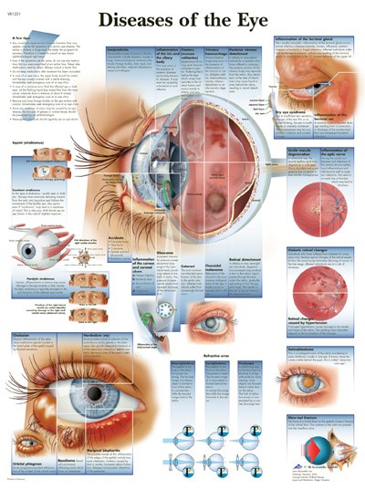 Wandkaart: Diseases Of The Eye