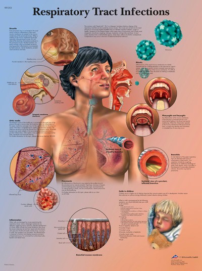 All Products - Respiratory Tract Infections