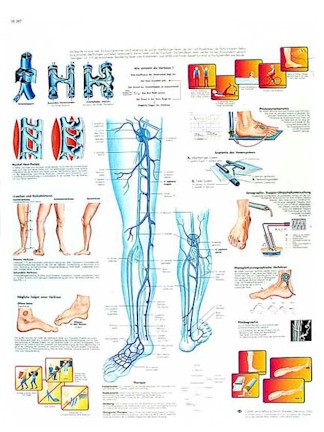 All Products - Varicose Veins